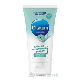 Oilatum krém ošetruje a chráni začervenanú pokožku 100ml